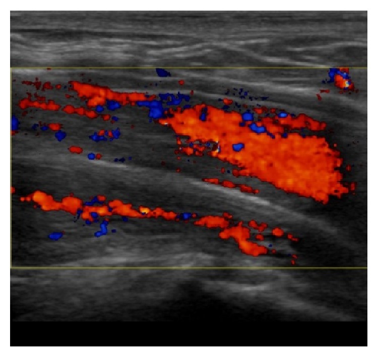 Figure 17