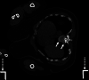 FIG 4.