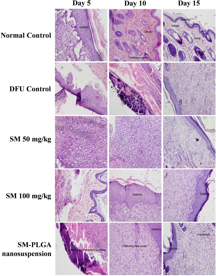 Figure 11