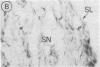562