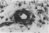 558