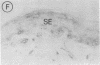 562