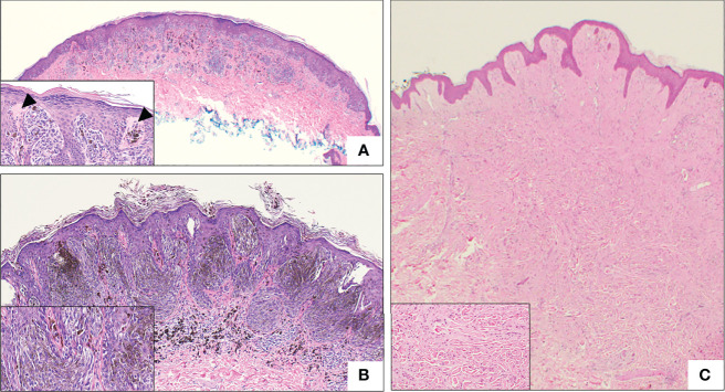 Figure 4