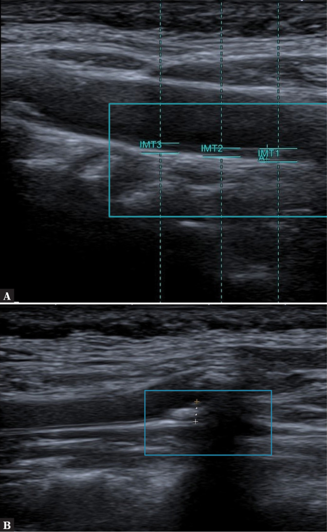 Fig. 11.