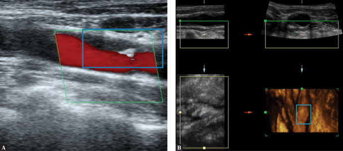 Fig. 6.