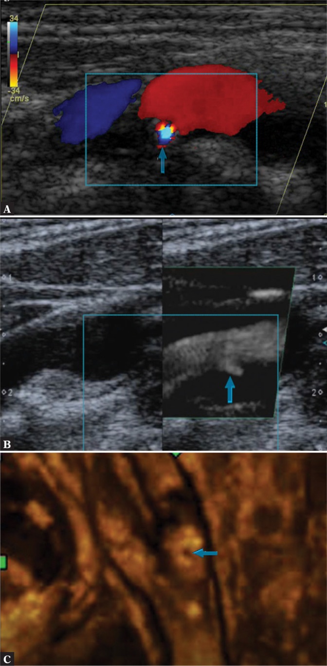 Fig. 12.