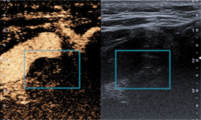 Fig. 17.