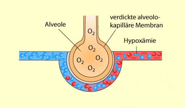 graphic file with name 6376_9_De_53_Fig3_HTML.jpg