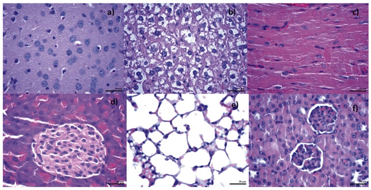 Figure 22