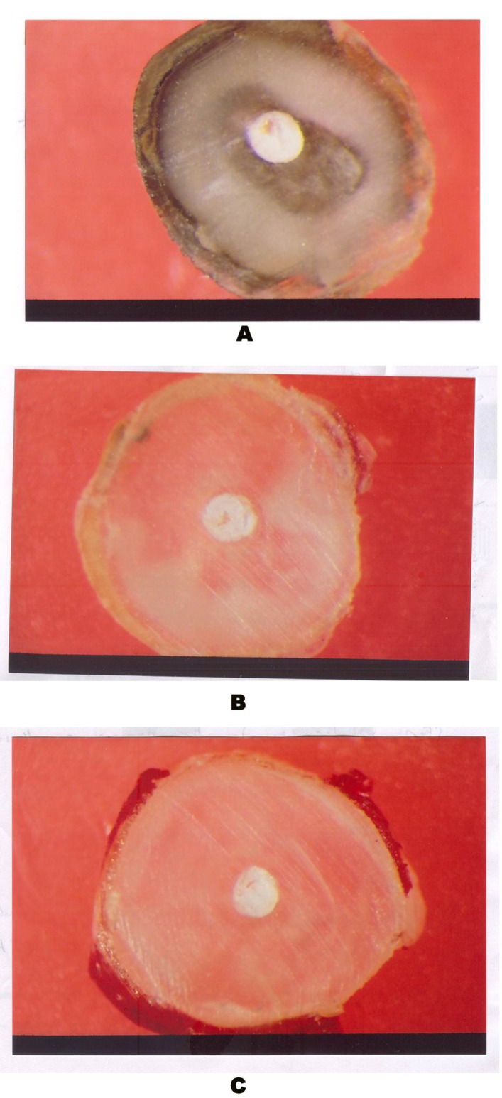 Fig. 20:Resilon – Section A, B & C