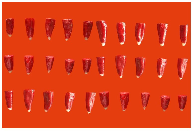 Fig. 16: Teeth Coated with Nail Varnish(30)