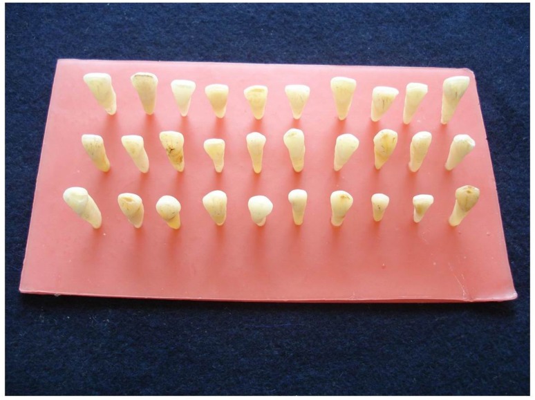 Fig. 13: Extracted Single Rooted Teeth(30)