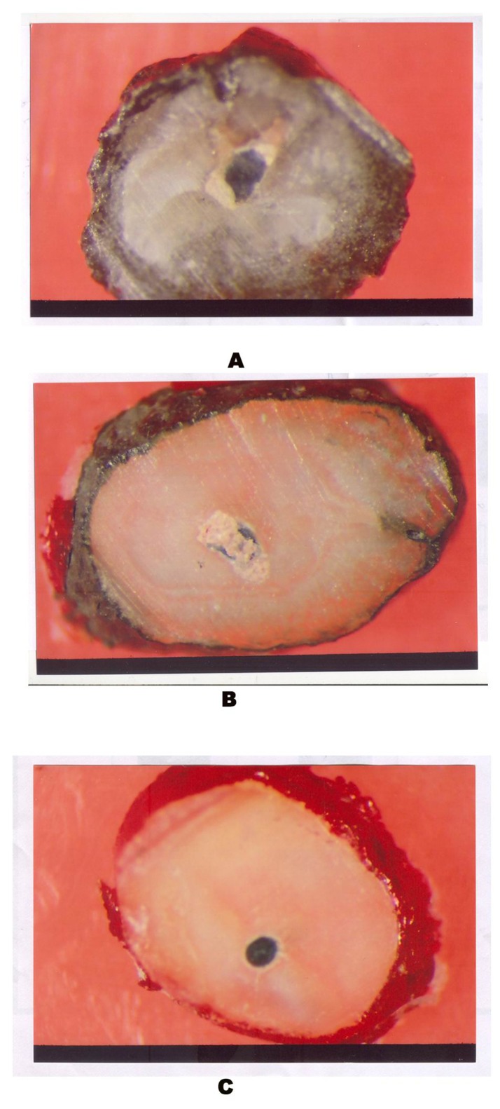 Fig. 21:Thermafil – Section A, B & C