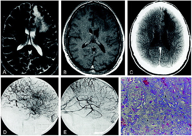 fig 3.