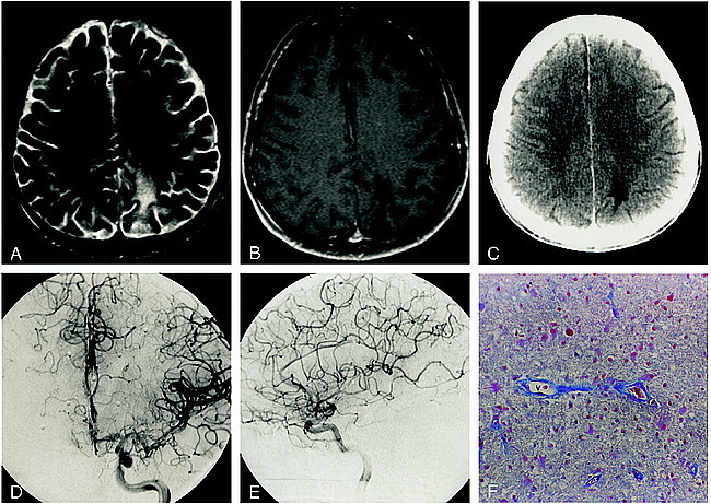 fig 4.