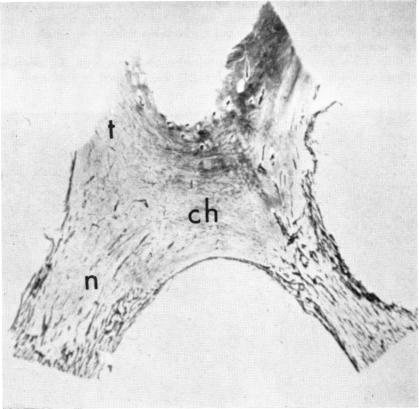 FIGURE 22