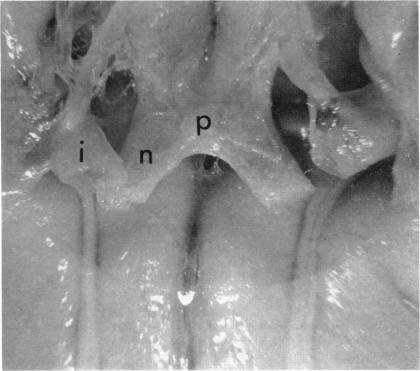 FIGURE 21