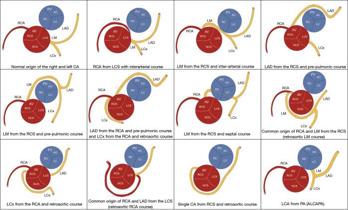 Figure 13