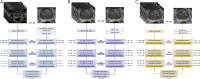 A, U-NetA neural network architecture. U-NetA localizes the prostate
by creating a bounding box around it and narrows the field of view (see
Appendix E1 [supplement]). The image is processed with nine layers that
consist of convolutions (Convs), batch normalization (Batch Norm), and
rectified linear unit (ReLU) activation. Both the contraction and expansion
pathways use convolutional kernels that have 1 × 3 × 3 and 2
× 1 × 1 filters. The image is downsampled to a 1 × 1
× 1 matrix before it is upsampled. B, U-NetB neural network
architecture. U-NetB completes prostate organ segmentation by classifying
each pixel as either belonging to the prostate or background. The image is
processed with six layers that consist of convolutions, batch normalization,
and ReLU activation. The contraction and expansion pathways use
convolutional kernels that have 1 × 3 × 3 and 2 × 1
× 1 filters. The image is collapsed to a 1 × 8 × 8
image before it is expanded. C, U-NetC neural network architecture. U-NetC
differentiates between transition zone and peripheral zone by classifying
every voxel in the image as one of these two classes. This classification
then identifies the border between these two prostate regions. U-NetC has
the same architecture as U-NetB and implements six layers that perform
convolutions, batch normalization, and ReLU activation. The convolutional
kernels use 1 × 3 × 3 and 2 × 1 × 1 filters. The
image is downsampled to a 1 × 8 × 8 image before it is
upsampled. 3D = three dimensional, 2D = two dimensional.