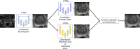 Three convolutional neural networks were combined to segment the
transition zone (TZ) and the peripheral zone (PZ). The T2-weighted prostate
MR image is first passed through U-NetA, which performs localization and
creates a bounding box around the prostate that narrows the field of view.
This output is then passed simultaneously to U-NetB and U-NetC. U-NetB
completes further localization by segmenting out the prostate organ itself,
while U-NetC classifies each pixel as either TZ or PZ. U-NetB’s
output is then used to identify the voxels in U-NetC that belong in the
prostate. After the appropriate voxels are selected in U-NetC’s
output, the final output with TZ and PZ segmentations is shown.
