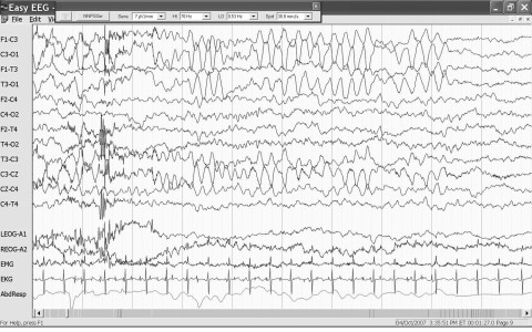 Figure 1)
