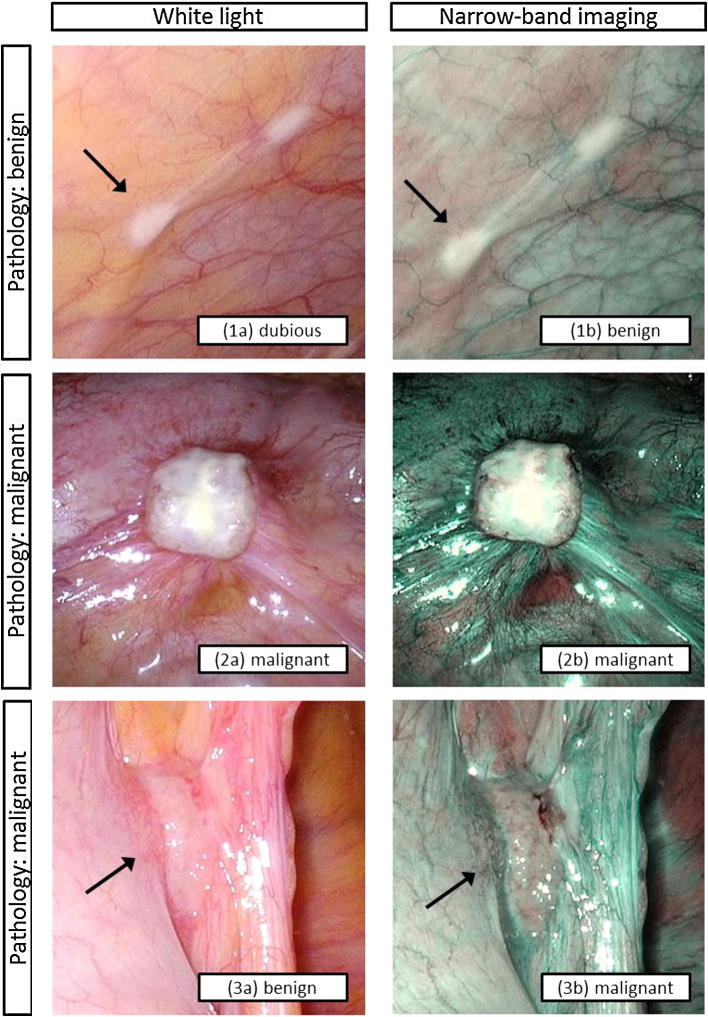 Fig. 1