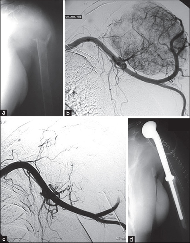 Figure 14