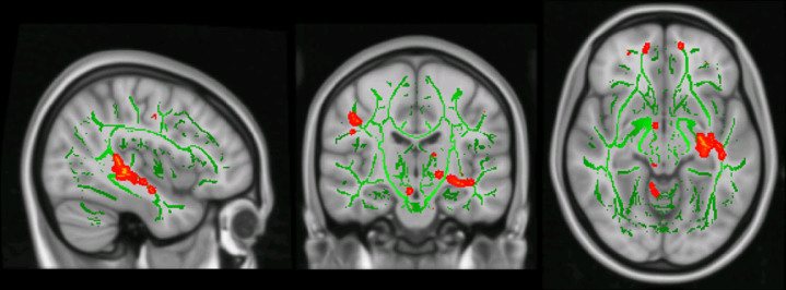 Fig.1