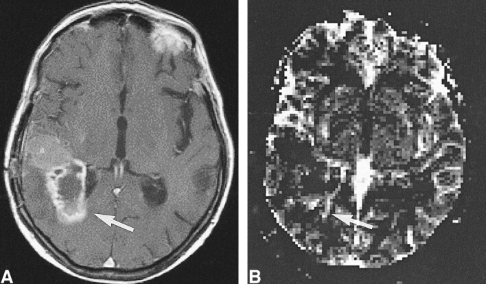 fig 6.