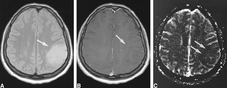 fig 2.