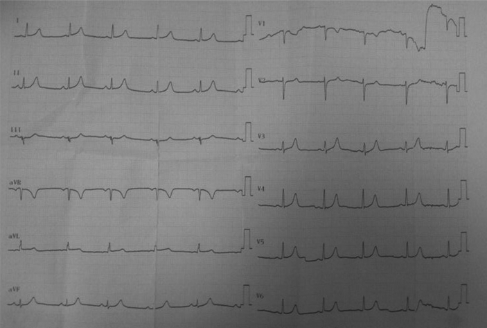 Fig. 1