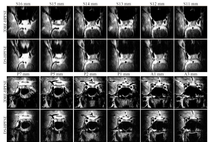 FIG. 14