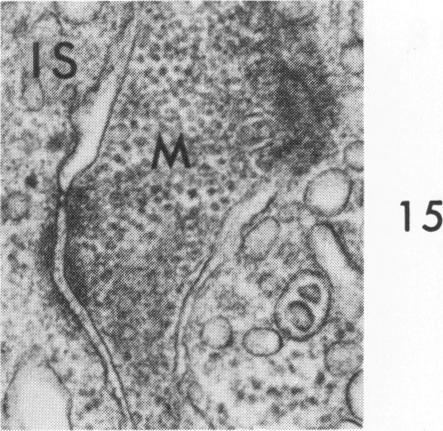 Fig 15