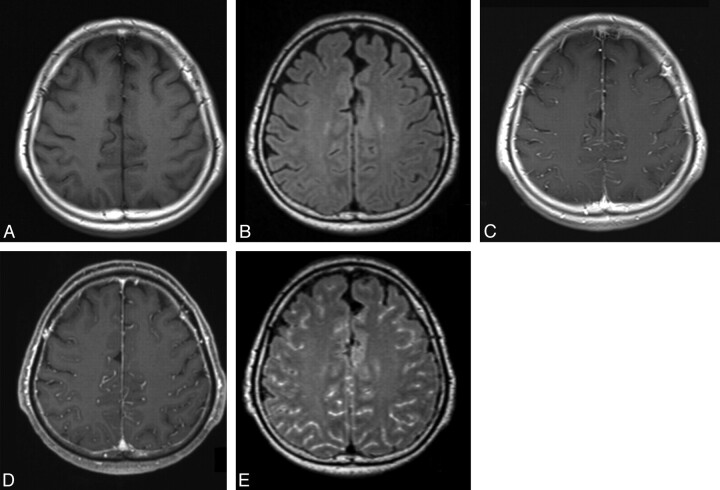 Fig 2.