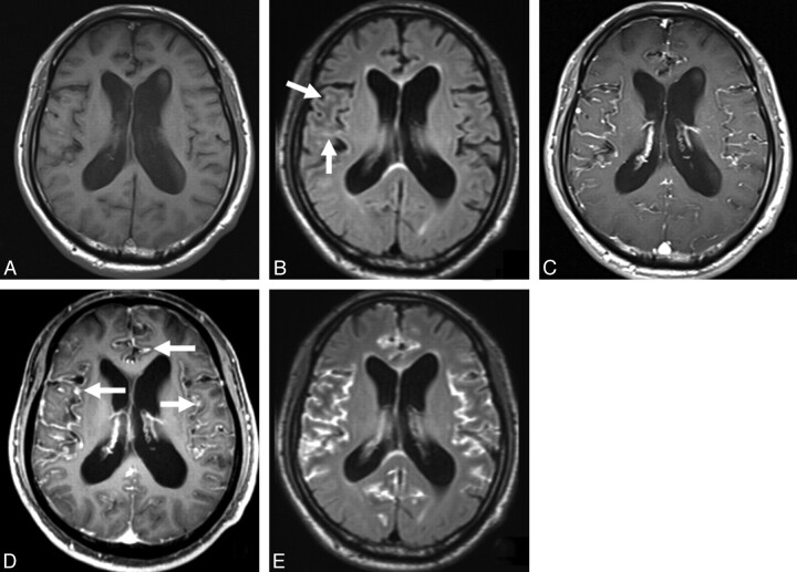 Fig 3.