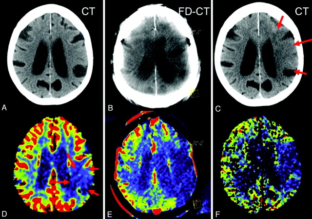 Fig 3.