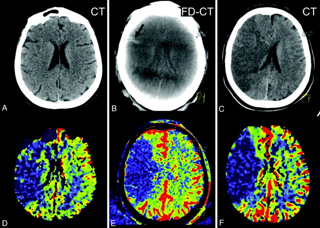 Fig 4.