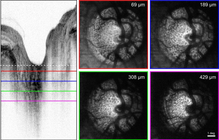 Fig. 11