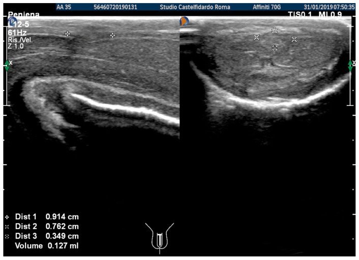 Figure 11