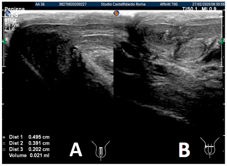 Figure 12