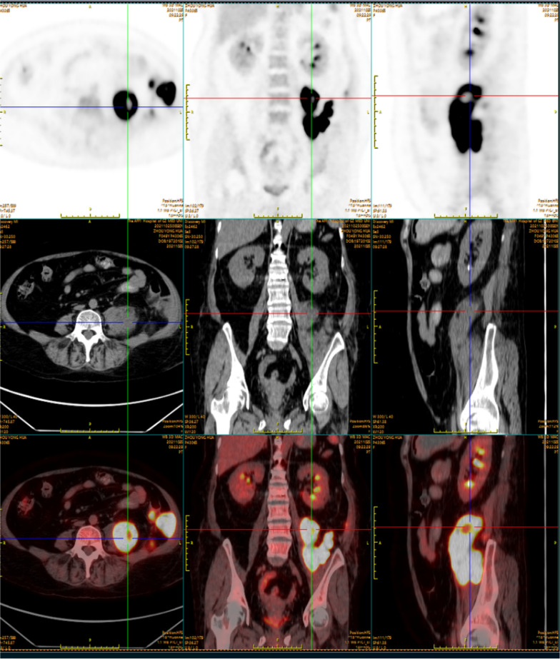 Fig. 1 