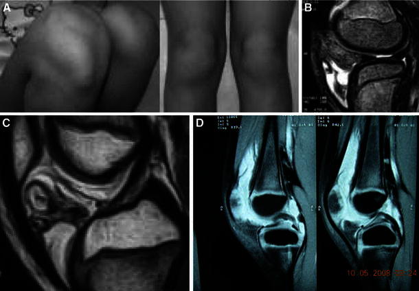 Fig. 4