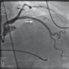 Figure 2B