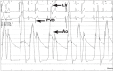 Figure 1B