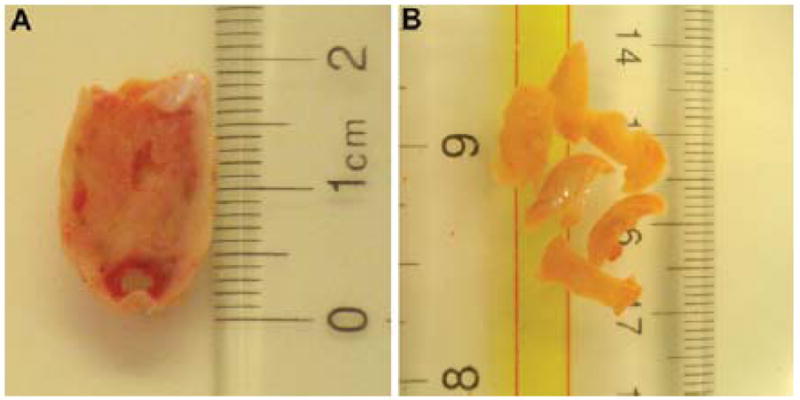 Fig. 3.3