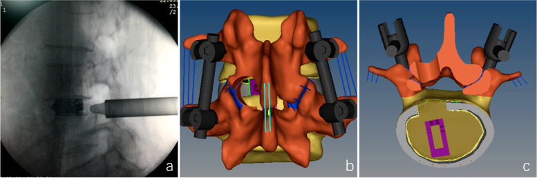 Fig. 3