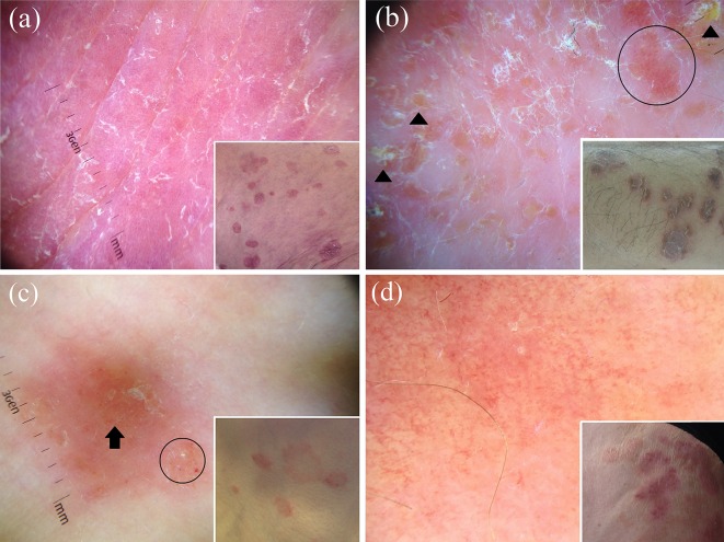 Fig. 1