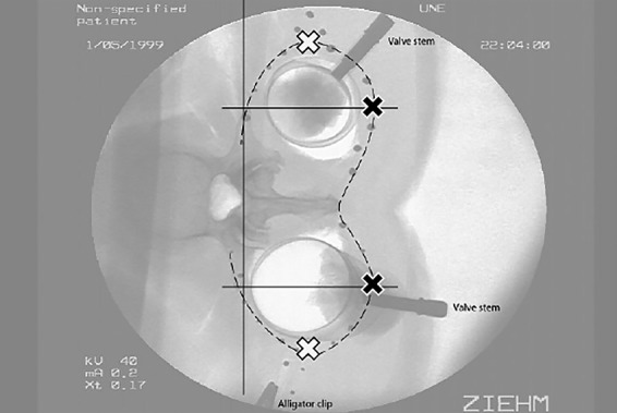 Fig. 2