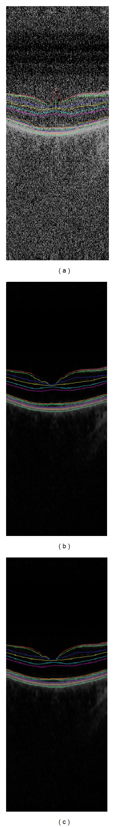 Figure 14