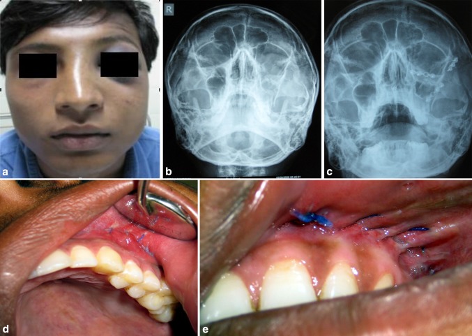 Fig. 1